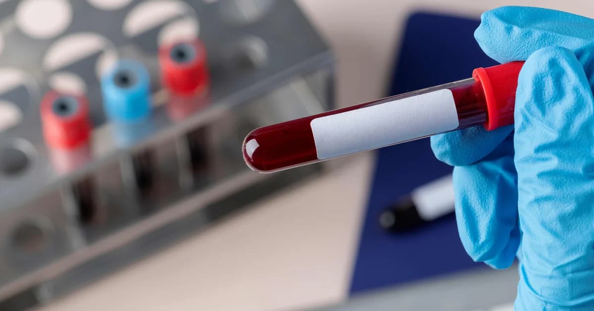 Cruz Vermelha mantém alerta após estoques de sangue chegarem a níveis críticos nos EUA